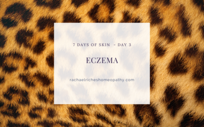 Eczema – Help is out there.